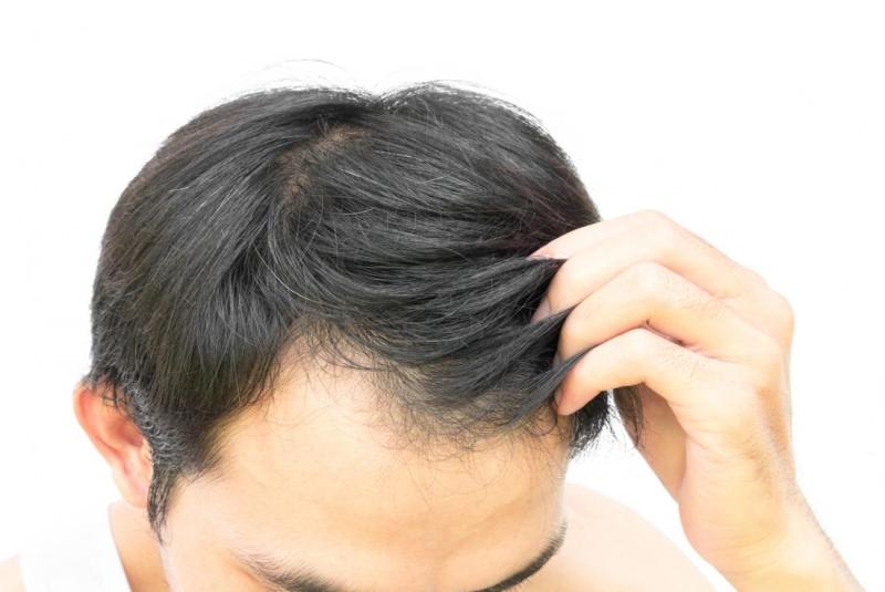 How To Restore Dead Hair Follicles