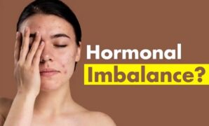 The Connection Between Hormonal Imbalance and Women’s Hair Loss