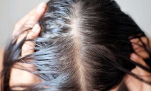 Stress-Induced Hair Loss in Women: Causes and Solutions