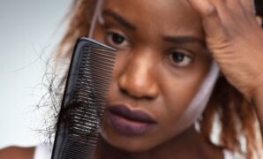 The Impact of Diet on Women’s Hair Loss: What You Need to Know